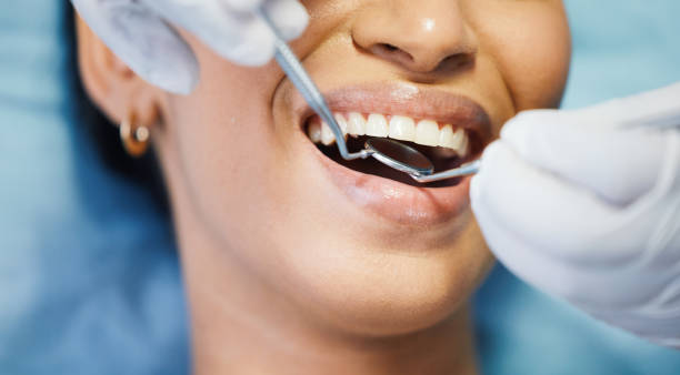 Best Holiday Emergency Dentist in Canyonville, OR